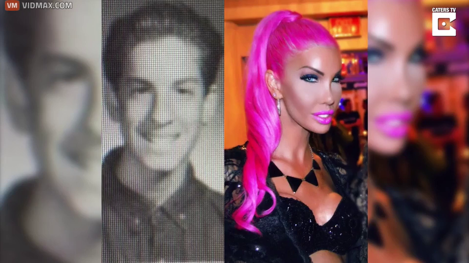 Transsexual Spends Million Transforming From Band Geek To Barbie